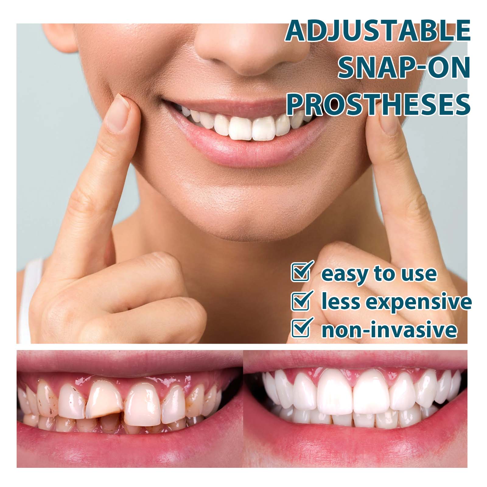 FlexSmile™ Dentures