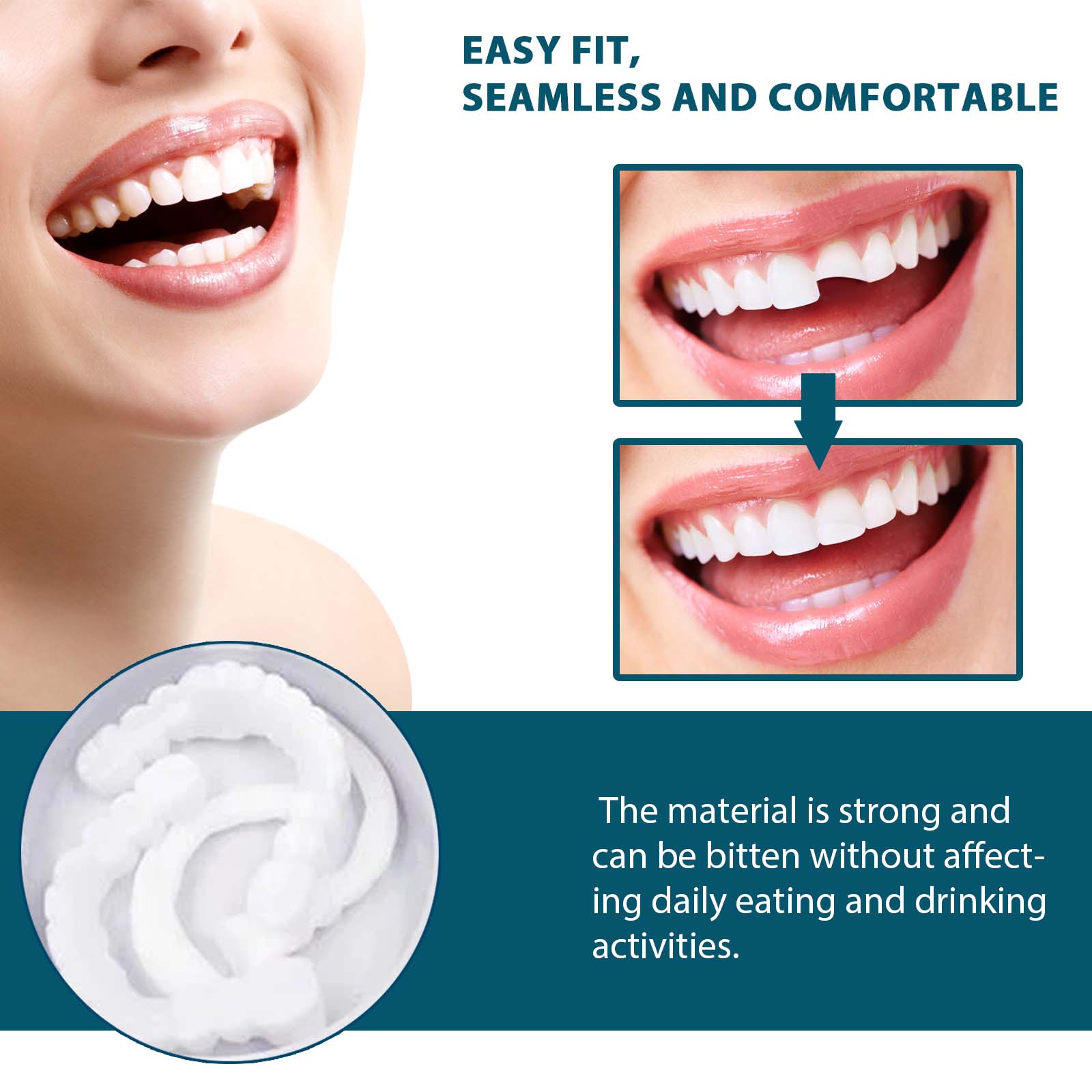 FlexSmile™ Dentures